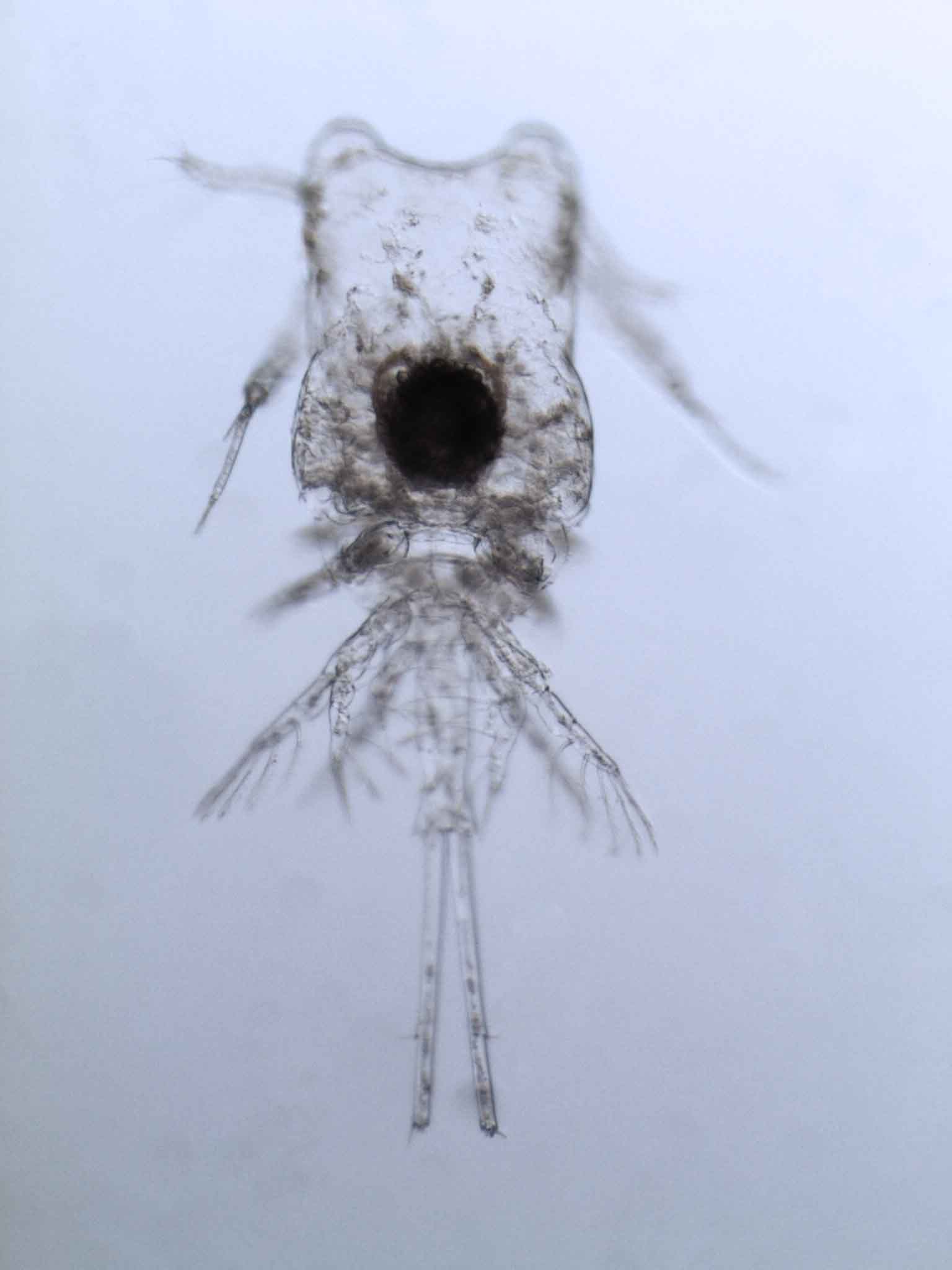 Plankton seen through a microscope